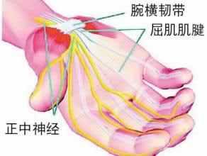 无法治愈的职业病？哭，我也在里面……告诉你鼠标手有多恐怖！