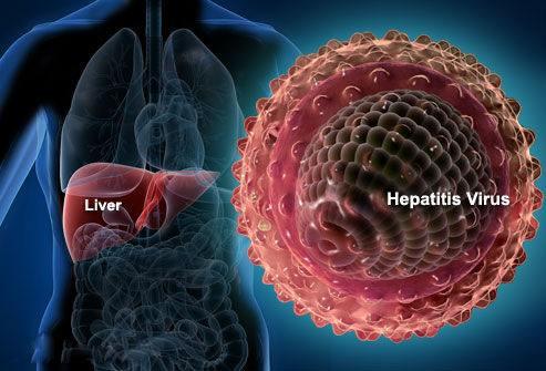 史上最全的慢性乙型肝炎预防手册，读完你就是半个专家！