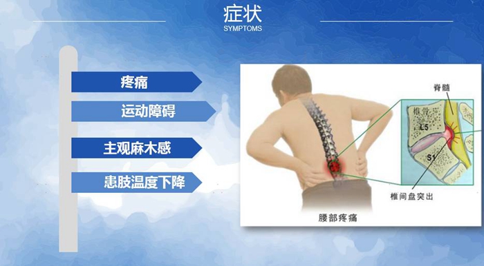 国康健康保险谈腰椎间盘突出