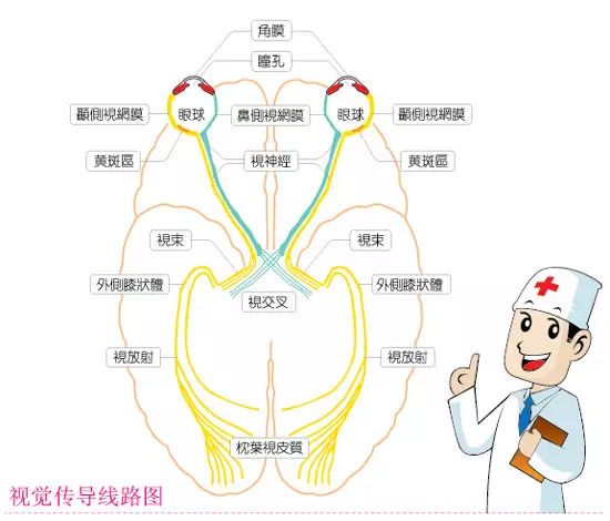 引起弱视示意图