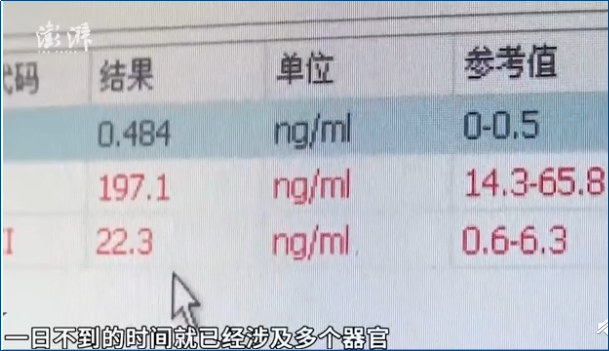 29岁女生因喝奶茶住进ICU，喝奶茶真能引发糖尿病吗？