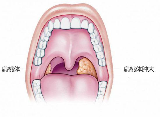 10个中国人9个口腔不健康，这些口腔知识你都知道吗？