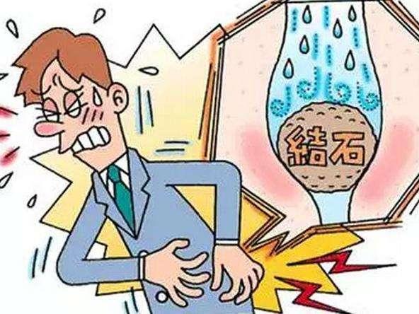 结石到底是怎么来的？怎么预防？读完这三段话你就知道了