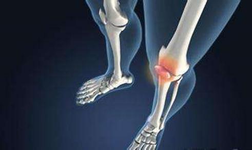 关节炎自我管理的4个绝招！快分享给身边膝盖痛的朋友吧