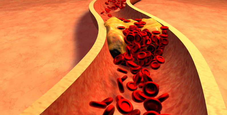 清晨身体出现这个症状，动脉易硬化！减缓血管老化的秘诀就在这里！ 