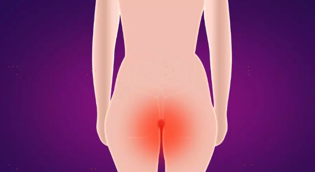 误诊！！！直肠癌患者约有60%以上曾被误诊为痔疮