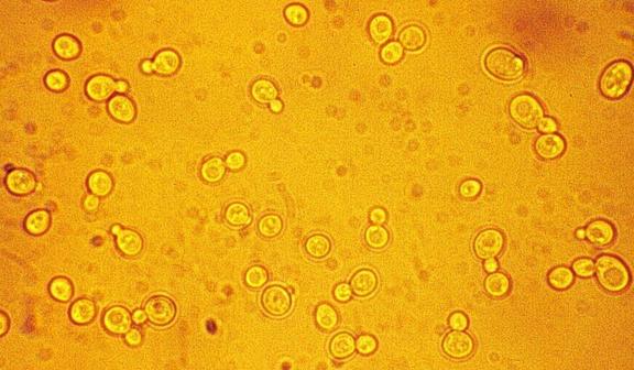 山梨酸作为防腐剂对人的危害大吗？它要先满足这些条件