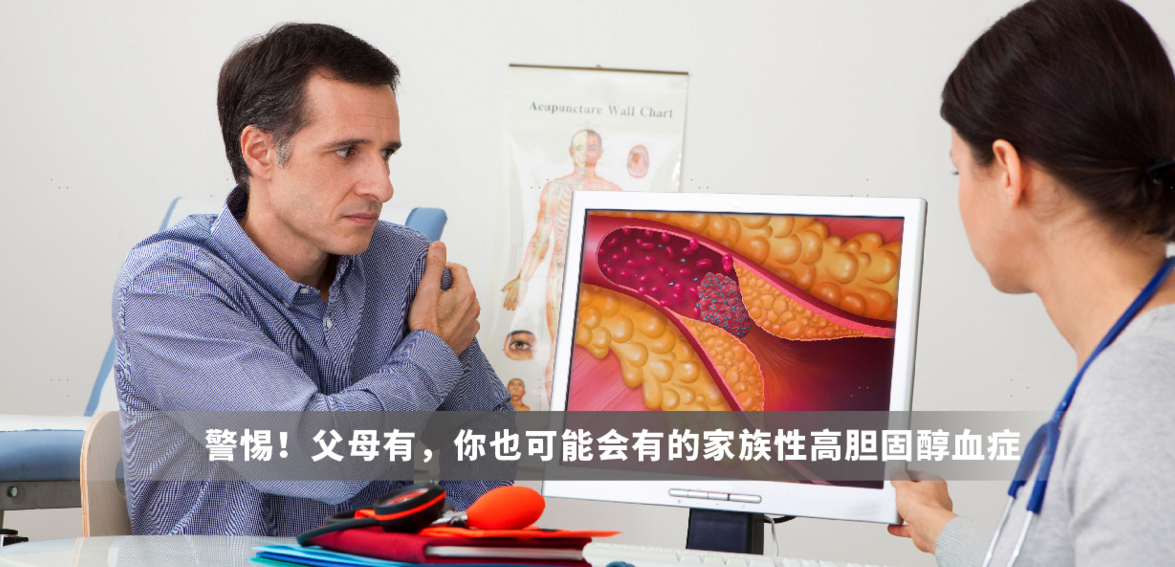 警惕！父母有，你也可能会有的家族性高胆固醇血症