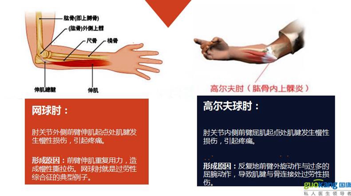 健康保险之运动损伤部位