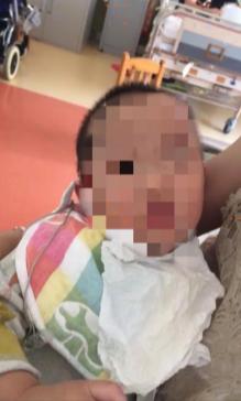 如何处理婴幼儿发烧？这位母亲的处理方式，毁了孩子的一生