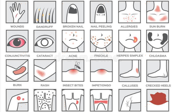 带状疱疹是神经损伤性疾病，50%以上的成年人一生中迟早会有一次发作