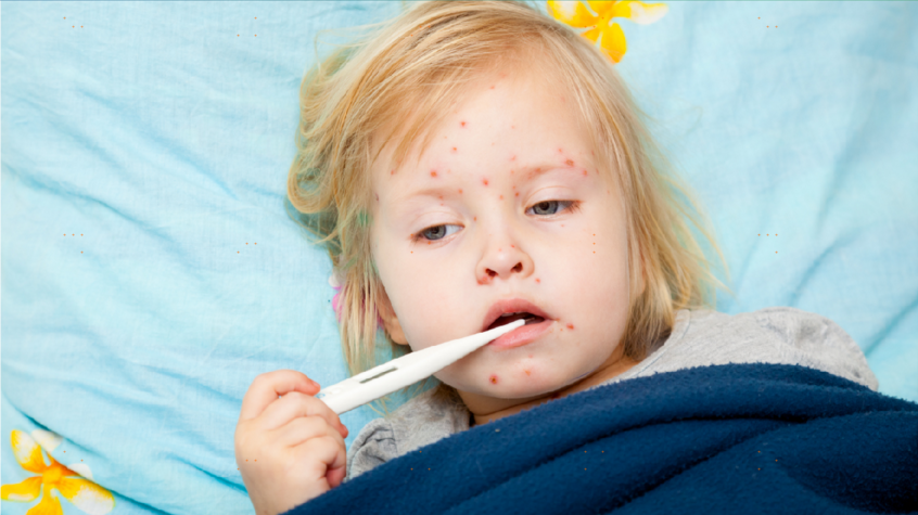 水痘，你所应该知道的那些事