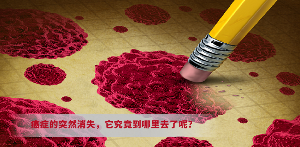 癌症的突然消失，它究竟到哪里去了呢？