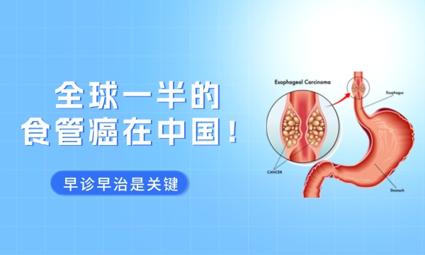 全球一半的食管癌在中国!早诊早治是关键