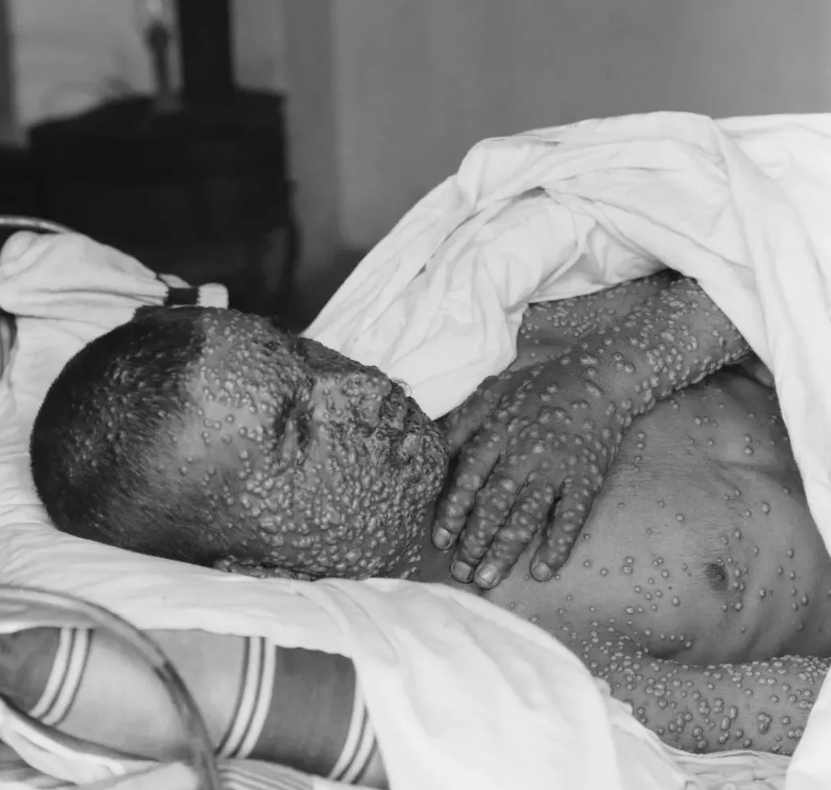 {xunruicms_img_title}