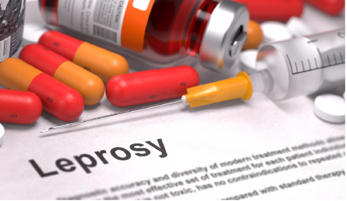 一个看似可怕，但并不邪恶的古老传染病