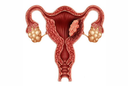 {xunruicms_img_title}