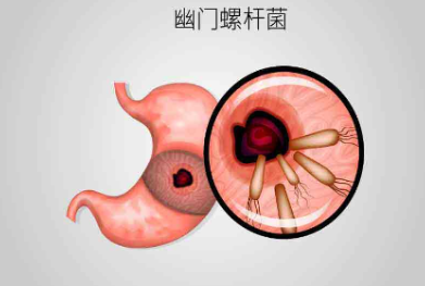 {xunruicms_img_title}