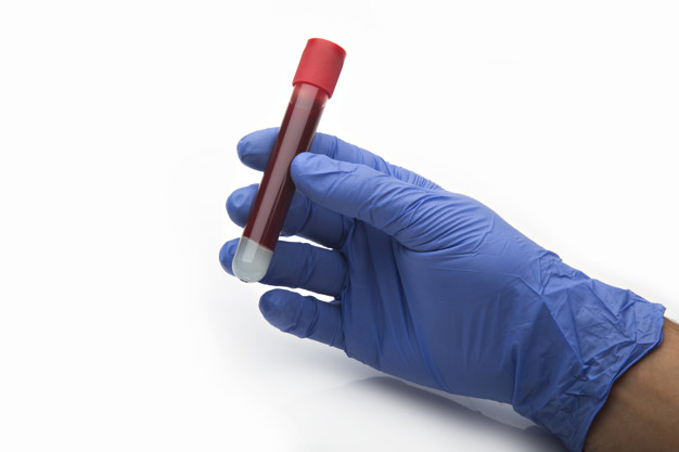 {xunruicms_img_title}