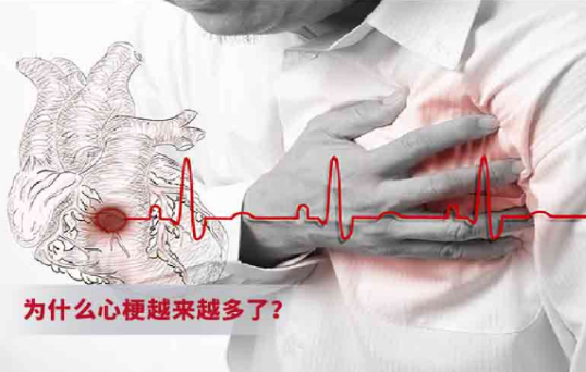 {xunruicms_img_title}