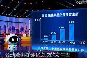 50岁副总裁亲测：颈动脉斑块真的能变小！